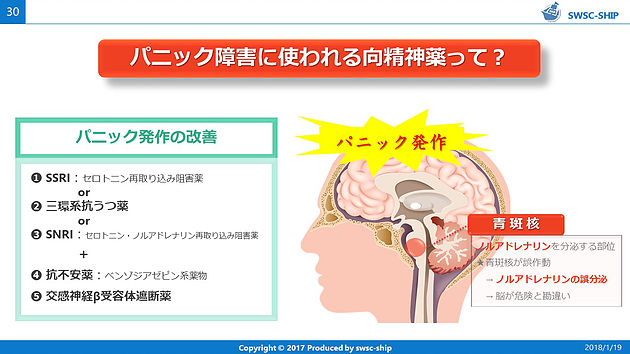 パニック 障害 薬